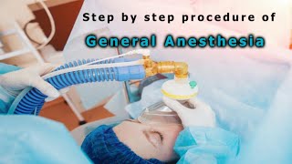 General anesthesia  step by step procedure [upl. by Notniuq]