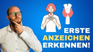 Erste Anzeichen von Schilddrüsenproblemen So erkennst du sie [upl. by Raseac685]