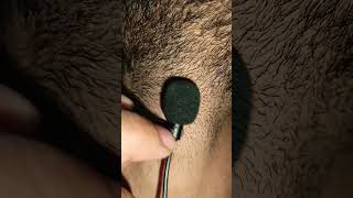 ingrown hair removal short haircare barbershop hairregrowth [upl. by Cece]