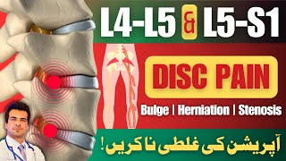 L4L5 amp L5S1 Disc Bulge Treatment  No Surgery  Home Treatment  UrduHindi [upl. by Eelanej]