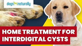 Home Treatment For Interdigital Cysts [upl. by Wilek]