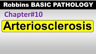 Ch10  Arteriosclerosis  Blood Vessel Pathology  Robbins Lectures [upl. by Sucramal]