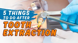 5 things to do after Tooth Extraction  Orthosquare Dental Clinic  Dental Care [upl. by Nailimixam162]