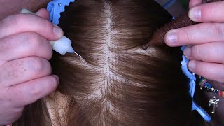 ASMR Scalp Check and Treatment Acupressure Massage Wooden Tools Scalp Massage Scalp Scratching [upl. by Richella]