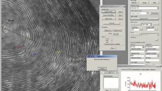 Otolith and Scale Analysis  ImagePro Plus Software [upl. by Ariec]