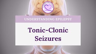 What are TonicClonic Seizures [upl. by Dory]