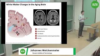 Dr Johannes Weickenmeier  A multiphysics model to predict periventricular white matter [upl. by Accisej532]