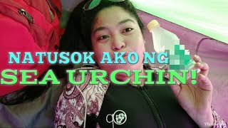 ANONG GAGAWIN KAPAG NATUSOK NG SEA URCHIN  Vlog  1  Sheng RomeroAkmad [upl. by Fowle]