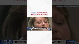 CARA MENGATASI MATA BERKEDUT blepharospasm botox [upl. by Arjun323]