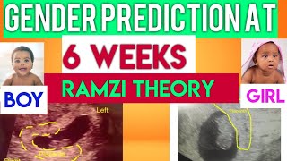 How to Predict baby gender at 6 weeks  Ramzi theory boy or girl [upl. by Whitebook]