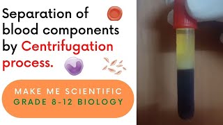 Separation of Human Blood Components by Centrifugation Process  Grade 812  Biology Demo [upl. by Enymsaj]