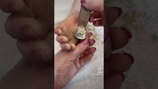 Removing callus from kid hands  Keratoderma hyperkeratosis EPPK skin shaving callous  Apr 2 2023 [upl. by Gael]