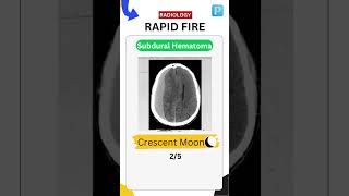 Radiology Rapid fire 3 [upl. by Teillo674]