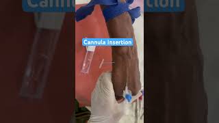 Cannula insertion of old female patient shorts cannula nurses subscribe doctor neet mbbs [upl. by Ellynad957]