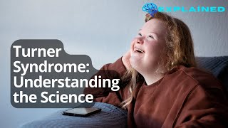 Turner Syndrome Understanding the Science [upl. by Atteram518]