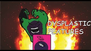 Dysplastic Features [upl. by Rebbecca]