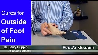 How to Treat Pain on the Outside of the Foot with Seattle Podiatrist Dr Larry Huppin [upl. by Rim427]