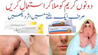 Contractubex Gel  Skinoren Cream Uses in urdu  How to Remove acne scar Dark spots  Pimple marks [upl. by Damara]