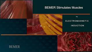 BEMER  A Look Inside our Microvascular System [upl. by Michaella200]