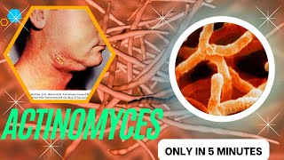 actinomyces microbiology lecture actinomyces Easy Microbiology [upl. by Ayital557]