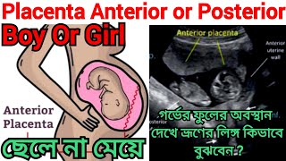 গর্ভে ছেলে না মেয়ে প্লাসেন্টার পজিসন Placenta Anterior Boy Or Girlbabybabyboyboy fhrpregnancy [upl. by Ecnerual926]