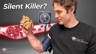 Why Blood Pressure is So Important amp How to Lower It [upl. by Annaierb650]