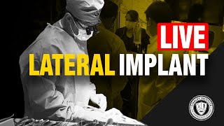 Lateral Implant Placement amp Temporization [upl. by Yellehs]