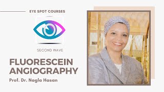 Fluorescein angiography by Prof Dr Nagla Hasan [upl. by Nnaynaffit]