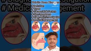 Rhinitis in Hindi  Causes Symptoms and Treatment of Rhinitis  Allergic And Non Allergic Rhinitis [upl. by Obaza]