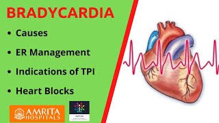 Causes amp Management of Bradycardia  Follow us on Twitter Link below👇 [upl. by Enayr]