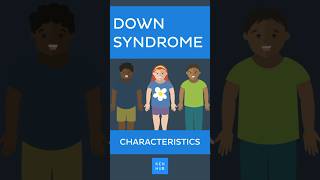 Down Syndrome Characteristics downsyndrome [upl. by Ysset49]