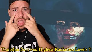 The man survived highest radiation Levels [upl. by Airtal]