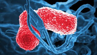 Dangerous strains of hypervirulent superbug detected in US and 15 other countries [upl. by Eijneb172]