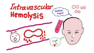 Intravascular Hemolysis [upl. by Yllah118]