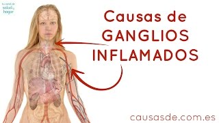 Causas de ganglios inflamados [upl. by Neirad299]