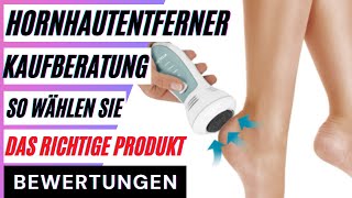 Hornhautentferner Kaufberatung So wählen Sie das richtige Produkt aus dem Hornhautentferner Test [upl. by Enilauqcaj446]