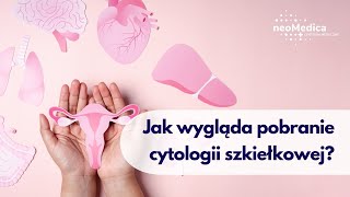 Jak wygląda pobranie cytologii szkiełkowej [upl. by Cioffred]