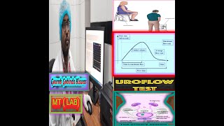 Urine test Uroflowmetry Bangla Uroflowmetry interpretation Urine Uroflowmetry [upl. by Grevera652]