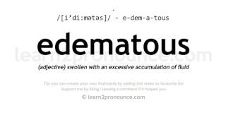 Pronunciation of Edematous  Definition of Edematous [upl. by Bucky586]