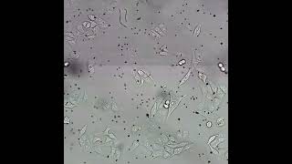 Supplementary Acoustic wave induced stroboscopic optical mechanotyping of adherent cells [upl. by Akire]