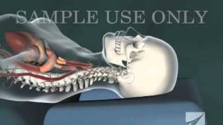 Cervical Chiropractic Adjustment [upl. by Noyerb]