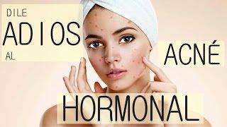 Cómo eliminar el ACNÉ HORMONAL 100 NATURAL [upl. by Mareld]