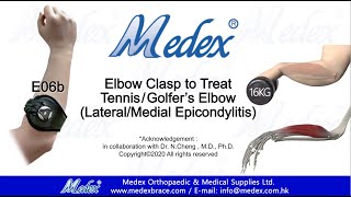 E06b  Elbow Clasp to treat TennisGolfers Elbow LateralMedial Epicondylitis 3d animation [upl. by Lletnuahs]