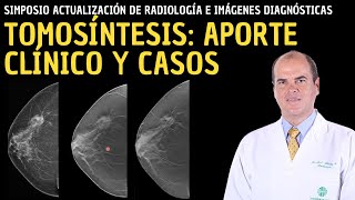 Actualización en radiología Tomosíntesis Aporte clínico y casos [upl. by Sessylu]