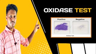 Oxidase Test AZ  in Bangla video [upl. by Light]