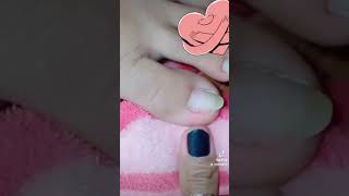 The Shocking Truth About BAD Wax Removal Methods nail​​​ nailart fyp ear shorts viral wax [upl. by Candi]