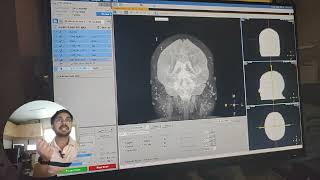 Venography MRI Contrast Explained MRVStep by Step on MRV plain as well as ContrastPart1 [upl. by Jandel]