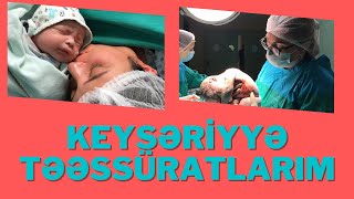 🔴KEYSERIYYE EMELIYYATI SONRASI TEESSURATLARIM [upl. by Steve]