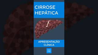 Cirrose hepática Apresentação clínica  Kenhub cirrose [upl. by Ehtylb868]