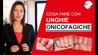 ONICOFAGIA E RICOSTRUZIONE UNGHIE Cosa fare con le Unghie Onicofagiche [upl. by Romine809]